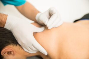 Dry Needling Austin TX